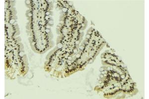 ABIN6267241 at 1/100 staining Mouse colon tissue by IHC-P. (JAK2 antibody  (pTyr931))