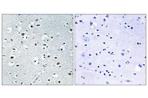 Immunohistochemistry analysis of paraffin-embedded human brain tissue using PPRC1 antibody.