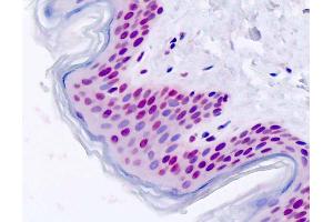 Human, Skin: Formalin-Fixed Paraffin-Embedded (FFPE) (FOXD1 antibody  (AA 1-30))