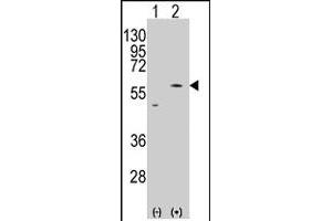 Western blot analysis of PMAT (SLC29A4) (arrow) using rabbit SLC29A4 polyclonal antibody . (SLC29A4 antibody  (AA 459-489))