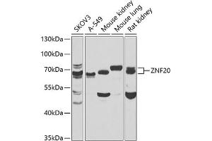 Western blot analysis of extracts of various cell lines, using ZNF20 antibody  at 1:1000 dilution. (ZNF20 antibody  (AA 1-200))