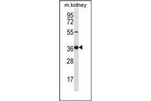 Western blot analysis of GRXCR1 Antibody (Center) in mouse kidney tissue lysates (35ug/lane). (GRXCR1 antibody  (Middle Region))
