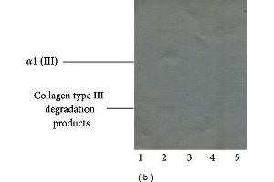 Western Blotting (WB) image for anti-Collagen, Type III, alpha 1 (COL3A1) antibody (ABIN5596830)