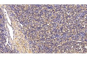 Detection of TGFb1 in Porcine Lymph node Tissue using Polyclonal Antibody to Transforming Growth Factor Beta 1 (TGFb1) (TGFB1 antibody  (AA 279-390))