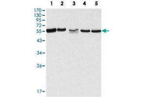 Western blot analysis using PAK2 monoclonal antibody, clone 3B5  against HeLa (1), Jurkat (2), A-549 (3), HEK293 (4) and K-562 (5) cell lysate. (PAK2 antibody)