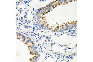 Immunohistochemistry of paraffin-embedded mouse lung using IRAK2 antibody. (IRAK2 antibody)