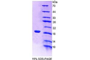 SDS-PAGE (SDS) image for Leucine Zipper, Down-Regulated in Cancer 1 (LDOC1) (AA 18-147) protein (His tag) (ABIN6238738) (LDOC1 Protein (AA 18-147) (His tag))