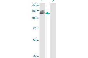 Western Blot analysis of NCAM1 expression in transfected 293T cell line by NCAM1 monoclonal antibody (M01), clone 3G12. (CD56 antibody  (AA 611-710))