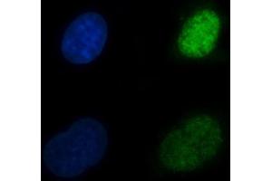 IF analysis of CBR1 using anti-CBR1 antibody (ABIN7600015). (CBR1 antibody  (AA 14-262))