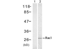 Western blot analysis of extract from A431 cell untreated or treated with EGF (200ng/ml, 5min), using Rac1 (Ab-71) antibody (E021201). (RAC1 antibody)