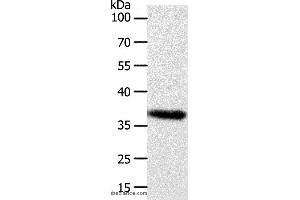 Western blot analysis of Hela cell, using AKR1B1 Polyclonal Antibody at dilution of 1:700 (AKR1B1 antibody)