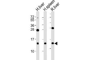 All lanes : Anti-CXCL11 Antibody at 1:2000 dilution Lane 1: human liver lysates Lane 2: human spleen lysates Lane 3: rat liver lysates Lysates/proteins at 20 μg per lane. (CXCL11 antibody)