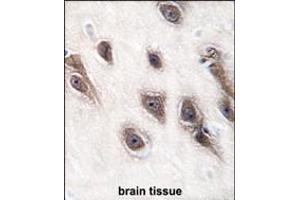 Formalin-fixed and paraffin-embedded human brain tissue reacted with GRB2 antibody (Center), which was peroxidase-conjugated to the secondary antibody, followed by DAB staining. (GRB2 antibody  (AA 89-118))