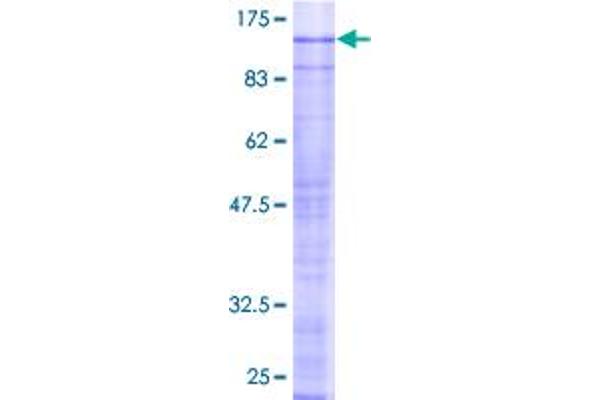 SRPK2 Protein (AA 1-688) (GST tag)