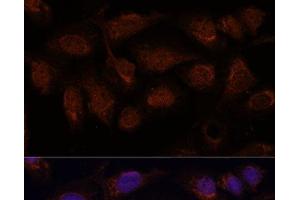 Immunofluorescence analysis of U-2 OS cells using PPP2CB Polyclonal Antibody at dilution of 1:100. (PPP2CB antibody)