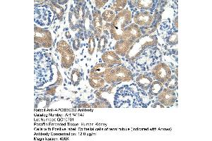 Rabbit Anti-APOBEC3D Antibody  Paraffin Embedded Tissue: Human Kidney Cellular Data: Epithelial cells of renal tubule Antibody Concentration: 4. (APOBEC3D antibody  (N-Term))