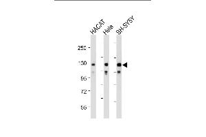 All lanes : Anti-SED Antibody (N-term) at 1:2000 dilution Lane 1: HACAT whole cell lysate Lane 2: Hela whole cell lysate Lane 3: SH-SY5Y whole cell lysate Lysates/proteins at 20 μg per lane. (SEMA6D antibody  (N-Term))