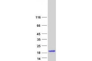 Validation with Western Blot (DEFA5 Protein (Myc-DYKDDDDK Tag))