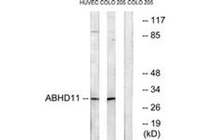 Western blot analysis of extracts from COLO/HuvEc cells, using ABHD11 Antibody.