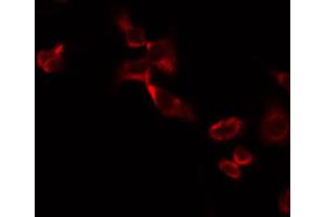 ABIN6274729 staining A549 by IF/ICC. (MRPL13 antibody  (C-Term))