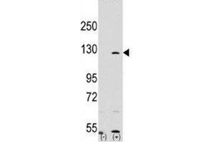 Western blot analysis of PARP antibody and 293 cell lysate (2 ug/lane) either nontransfected (Lane 1) or transiently transfected with the PARP1 gene (2). (PARP1 antibody  (AA 183-214))
