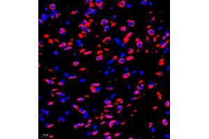 Immunofluorescence of paraffin embedded rat brain using P4H (ABIN7074215) at dilution of 1:700 (400x lens) (HIF Prolyl Hydroxylase antibody)