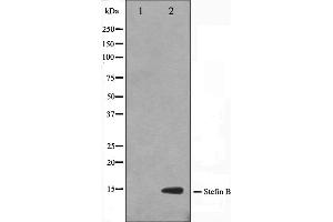 Western blot analysis on A549 cell lysate using CSTB Antibody,The lane on the left is treated with the antigen-specific peptide. (CSTB antibody  (C-Term))