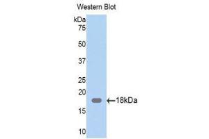 Western Blotting (WB) image for anti-Zyxin (ZYX) (AA 377-523) antibody (ABIN1860974) (ZYX antibody  (AA 377-523))