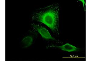 Immunofluorescence of monoclonal antibody to GDE1 on HeLa cell.