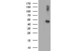 Western Blotting (WB) image for anti-Adaptor-Related Protein Complex 2, mu 1 Subunit (AP2M1) (AA 97-383) antibody (ABIN1491720) (AP2M1 antibody  (AA 97-383))
