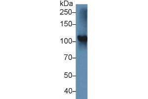 Western blot analysis of Rat Thyroid lysate, using Mouse TPO Antibody (5 µg/ml) and HRP-conjugated Goat Anti-Rabbit antibody (