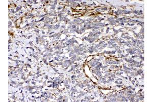 IHC analysis of Cytoglobin using anti- Cytoglobin antibody . (CYGB antibody  (AA 1-190))