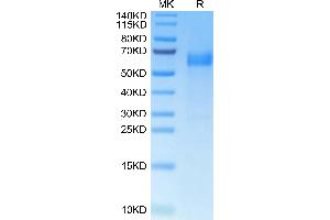 Human B7-H7 on Tris-Bis PAGE under reduced condition. (HHLA2 Protein (AA 23-344) (His tag))