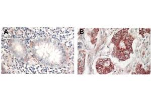 Immunohistochemistry (IHC) image for anti-V-Akt Murine Thymoma Viral Oncogene Homolog 1 (AKT1) (C-Term) antibody (ABIN94783)