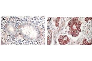 Immunohistochemistry of Rabbit Anti-AKT antibody. (AKT1 antibody  (C-Term))