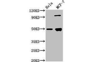 Western Blot Positive WB detected in: Hela whole cell lysate, MCF-7 whole cell lysate All lanes: GFAP antibody at 3. (GFAP antibody  (AA 292-432))