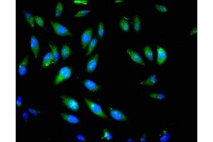 Immunofluorescent analysis of Hela cells using ABIN7163192 at dilution of 1:100 and Alexa Fluor 488-congugated AffiniPure Goat Anti-Rabbit IgG(H+L) (PIK3CB antibody  (Catalytic Subunit beta))