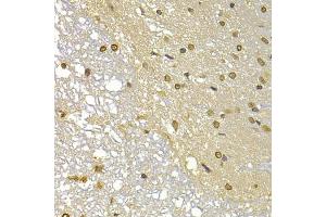 Immunohistochemistry of paraffin-embedded rat brain using S100A4 antibody (ABIN5970801) at dilution of 1/100 (40x lens). (s100a4 antibody)