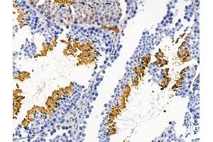 ABIN7094644 and ABIN7098694 at 1/100 staining Mouse testis tissue by IHC-P. (Plastin 3 antibody  (Internal Region))