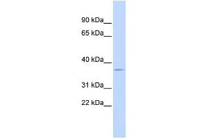 WB Suggested Anti-DUSAntibody Titration:  0.