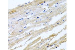 Immunohistochemistry of paraffin-embedded Rat heart using BNIP3 Polyclonal Antibody at dilution of 1:100 (40x lens). (BNIP3 antibody)