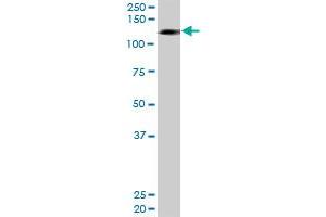 HIP1R MaxPab rabbit polyclonal antibody. (HIP1R antibody  (AA 1-1068))