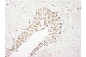 Immunohistochemistry (IHC) image for anti-ATR Interacting Protein (ATRIP) (AA 100-150) antibody (ABIN7448424)