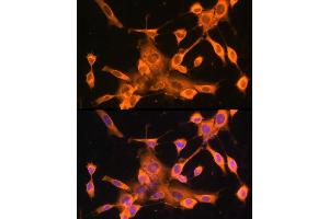 Immunofluorescence analysis of NIH-3T3 cells using FOXO3A Rabbit pAb (ABIN6129381, ABIN6140755, ABIN6140756 and ABIN6213618) at dilution of 100 (40x lens). (FOXO3 antibody  (AA 394-672))