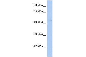 WB Suggested Anti-TFDP3 Antibody Titration:  0.
