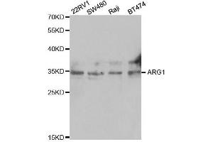 Western Blotting (WB) image for anti-Arginase, Liver (ARG1) antibody (ABIN1875417) (Liver Arginase antibody)