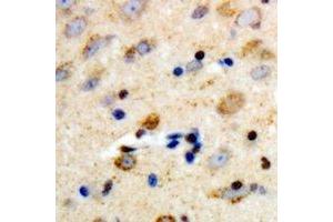 Immunohistochemical analysis of PLC beta 3 staining in human brain formalin fixed paraffin embedded tissue section. (PLCB3 antibody  (C-Term))