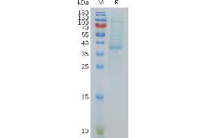 Chemokine (C-X-C Motif) Ligand 13 (CXCL13) protein (Fc Tag)