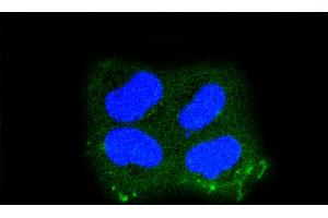 HeLa cells were fixed in paraformaldehyde, permeabilized with 0. (Keratin 10 antibody)