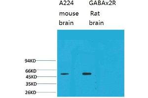 Western Blot (WB) analysis of 1) Mouse Brain Tissue, 2)Rat Brain Tissue with GABA A Receptor alpha2 Rabbit Polyclonal Antibody diluted at 1:2000. (GABRA2 antibody)